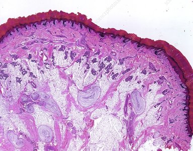 Micrograph of Pacinian corpuscle in the dermis