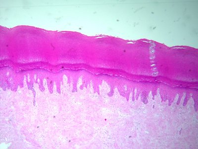 Histological section of thick skin showing epidermal layers