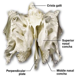 Ethmoid bone, anterior view