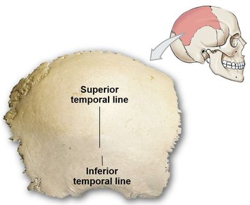 Parietal bone with temporal lines