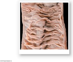 Gross anatomy of the jejunum