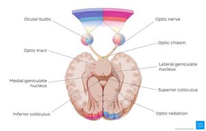 Myopia and Hyperopia Diagram
