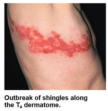 Dermatome map, anterior and posterior views