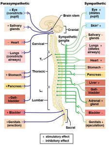 Shingles outbreak along T4 dermatome