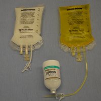 Enteral nutrition illustration