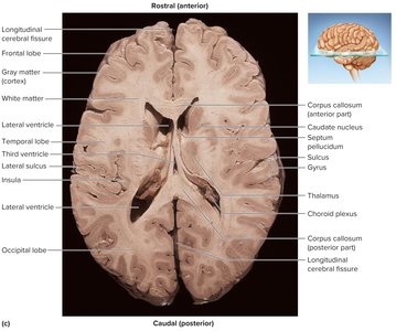 Brain section showing ventricles and gray/white matter