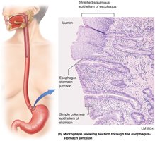 Micrograph showing section through the esophagus-stomach junction