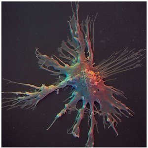 Dendritic cell as an antigen-presenting cell
