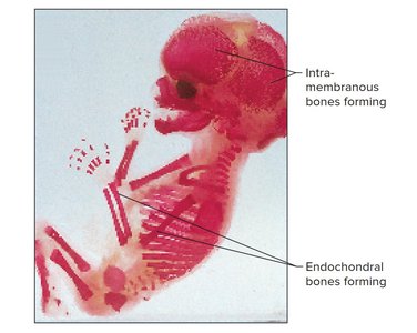 Embryo showing intramembranous and endochondral bone formation