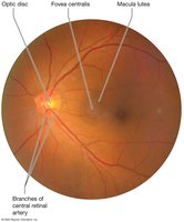 Photo of interior of the eye