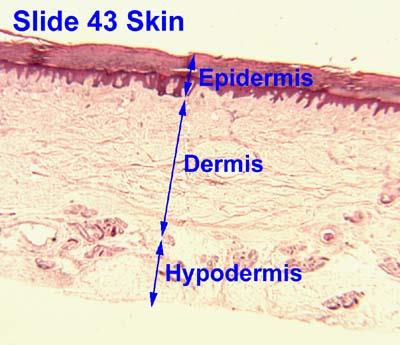 Histological slide showing epidermis, dermis, and hypodermis
