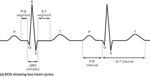 ECG showing two heart cycles