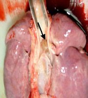 Dissection showing the carina at the tracheal bifurcation
