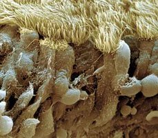 Electron micrograph of respiratory epithelium with cilia