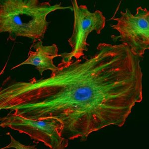 Cytoskeletal filaments stained in a eukaryotic cell