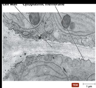 Cell wall and cytoplasmic membrane in eukaryote