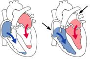 Normal E/A ratio and deceleration time