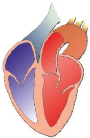 Diagram of a dilated left ventricle in systolic dysfunction