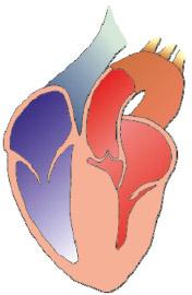 Diagram of a non-dilated, stiff left ventricle in diastolic dysfunction