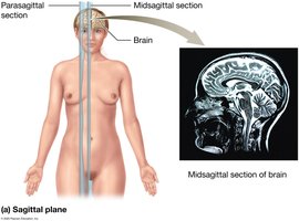 Sagittal plane