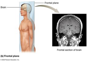 Frontal plane