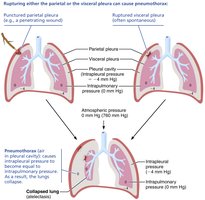 Mechanism of pneumothorax and lung collapse