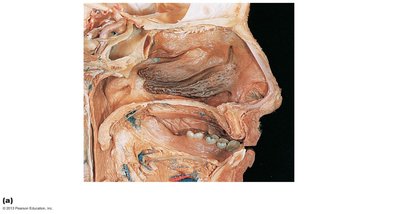 Photograph of a sagittal section of the head showing the nasal cavity and pharynx