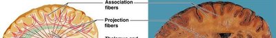 Diagram of white matter tracts and basal nuclei