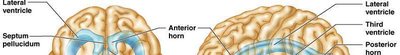 Diagram of the ventricular system of the brain