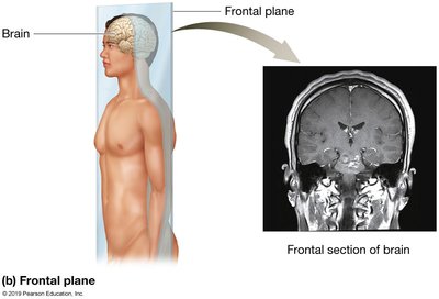 Transverse Plane