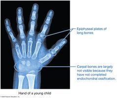 X-ray of child's hand showing epiphyseal plates