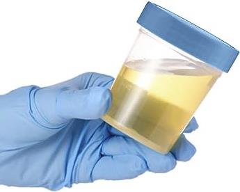 Urine sample as final waste product