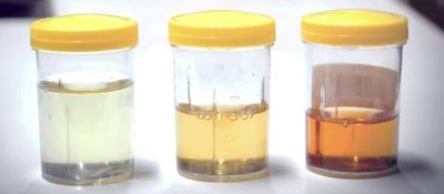 Urine samples of different concentrations