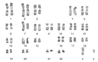 Human karyotype