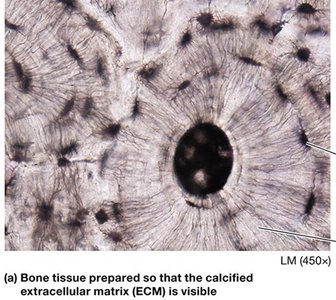 Bone tissue showing calcified ECM
