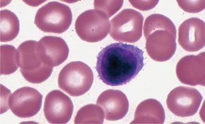 Lymphocyte