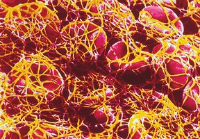 Electron Micrograph of RBCs in Fibrin Thread Meshwork