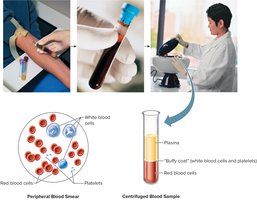 Blood Consists of Plasma and Formed Elements