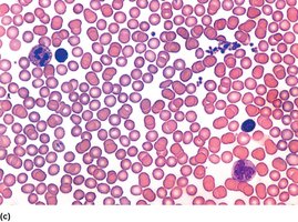 Non-agglutinated blood