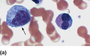 Hematopoietic Stem Cell