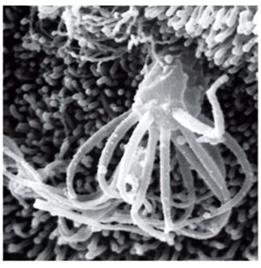 Electron micrograph of olfactory cilia, the site of odorant detection
