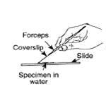 Wet mount preparation diagram