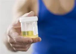 Urine sample for analysis