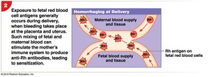 HDN: exposure to fetal antigens at delivery