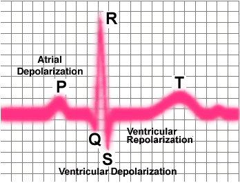 Labeled EKG waveform showing P, QRS, and T waves