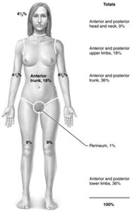 Rule of nines for estimating burn extent