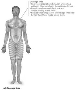 Diagram of cleavage lines in the skin