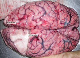 Gray and White Matter in the Brain
