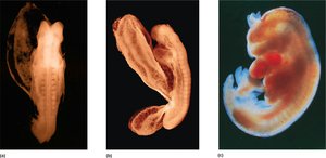 Embryo at 3, 3.5, and 4 weeks