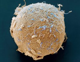 Sperm around oocyte